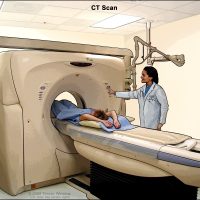 CT SCAN
