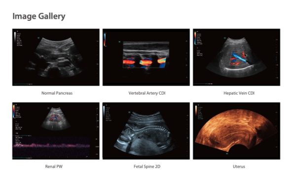 Mindray Consona N6 Diagnostic Ultrasound System - Image 3
